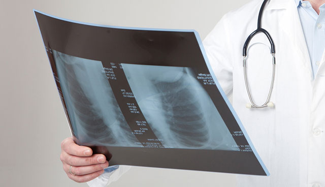 病院でレントゲンに異常がないと診断された
